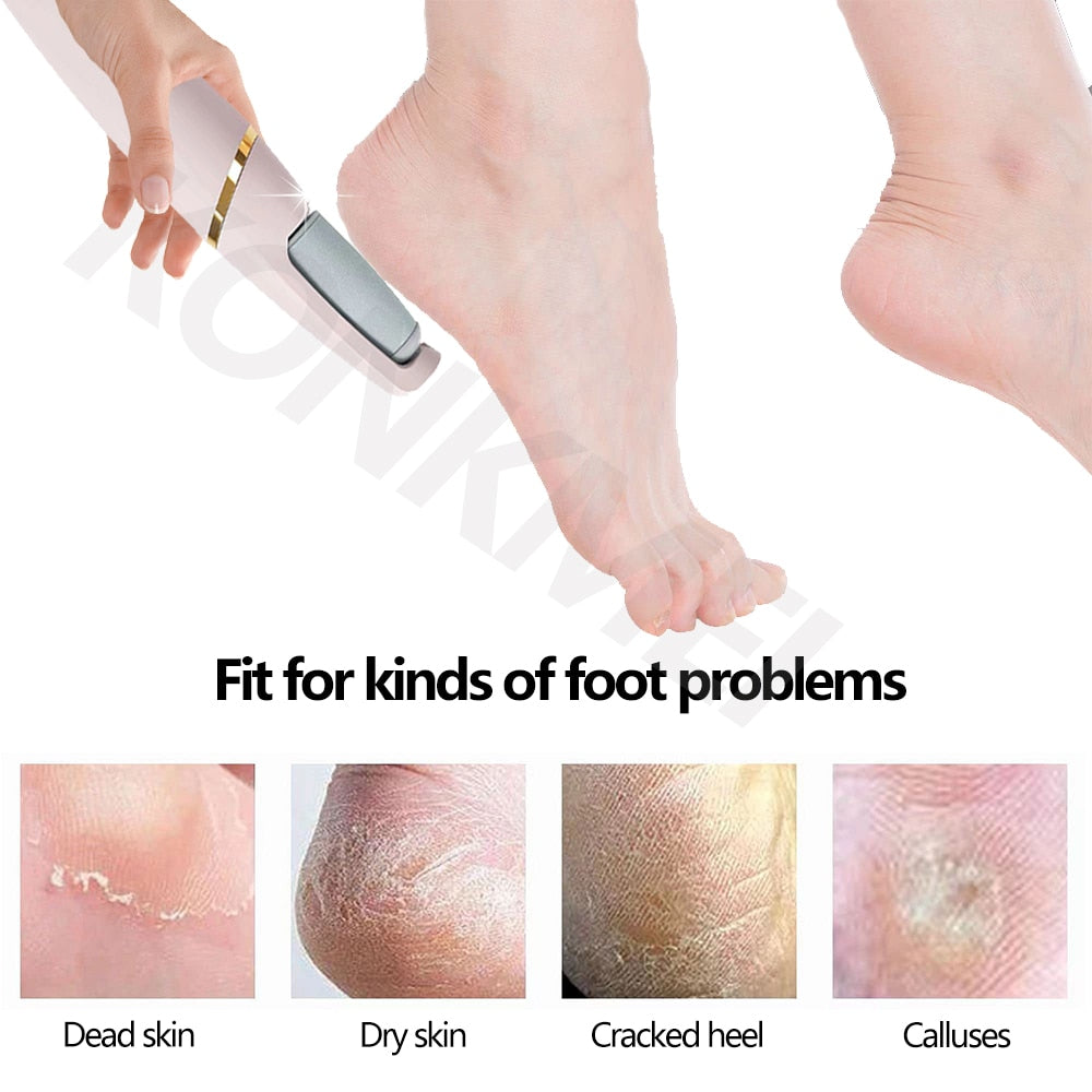 Professional Electric Foot Callus Remover - UTILITY5STORE