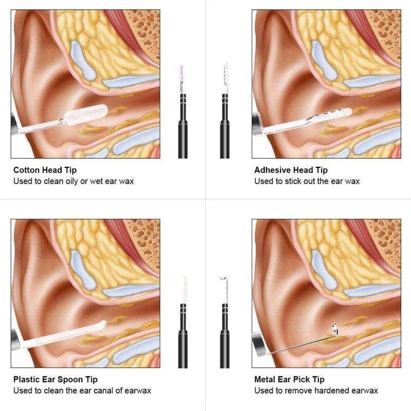 Mini Camera Visual Ear Cleaner